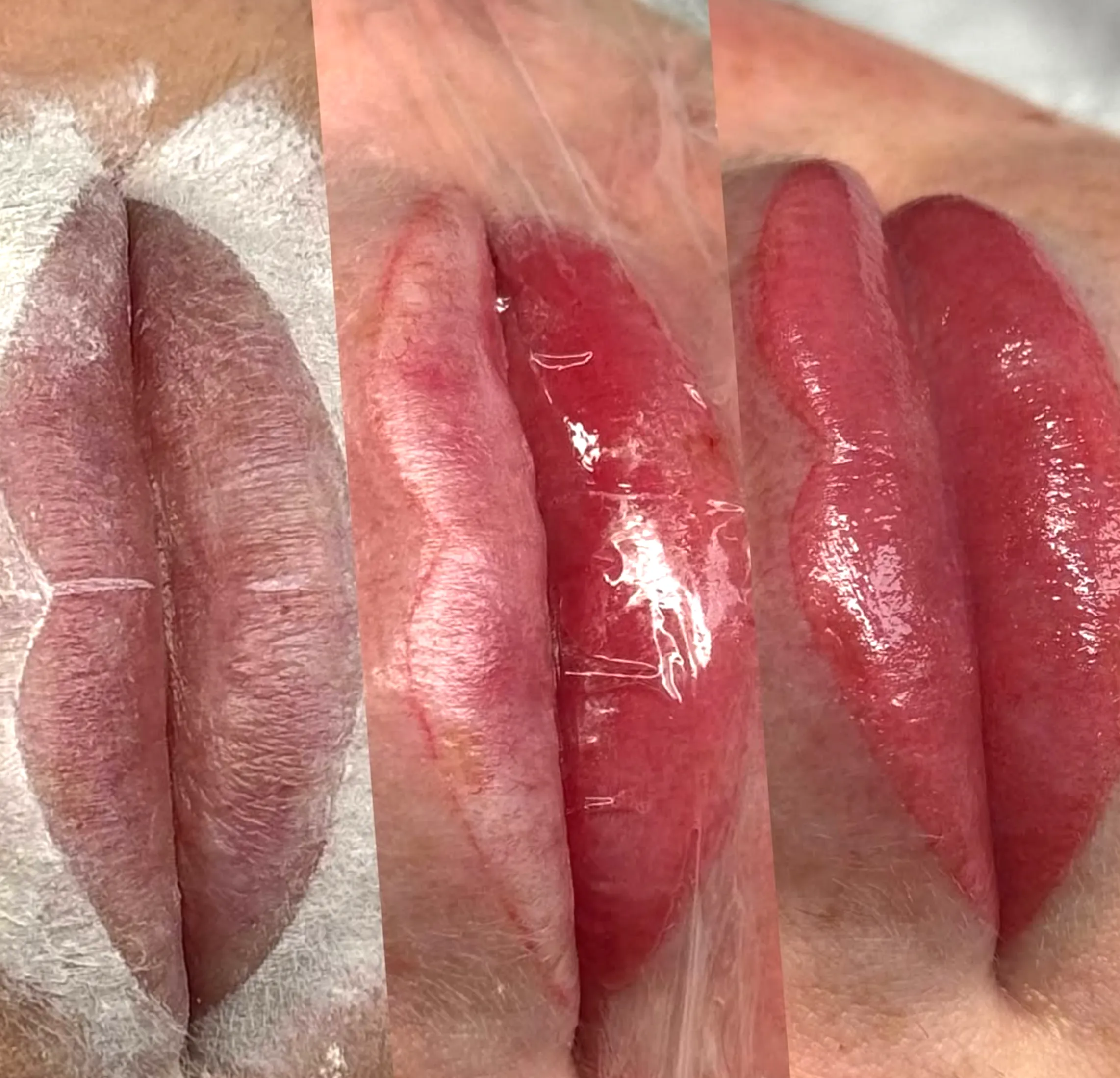 brocante-entre2siecles | What is an alternative to lip blushing?