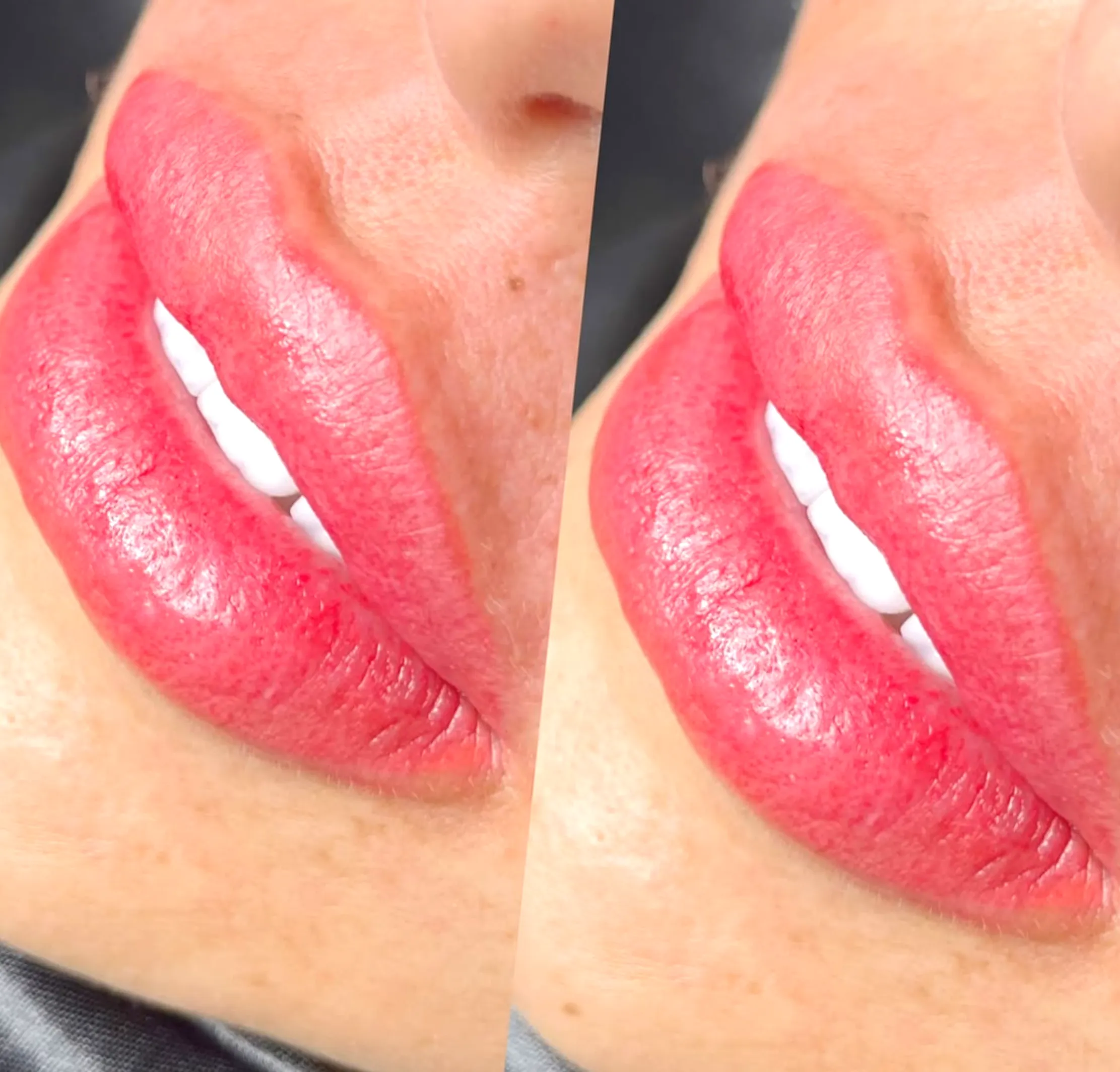 brocante-entre2siecles | What is an alternative to lip blushing?